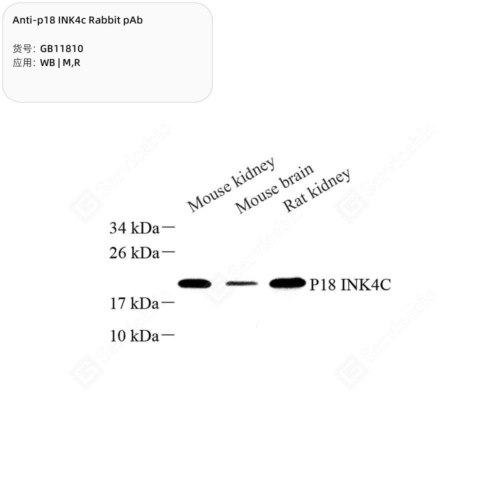 Anti-p18 INK4c Rabbit pAb