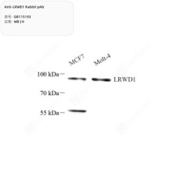 Anti-LRWD1 Rabbit pAb