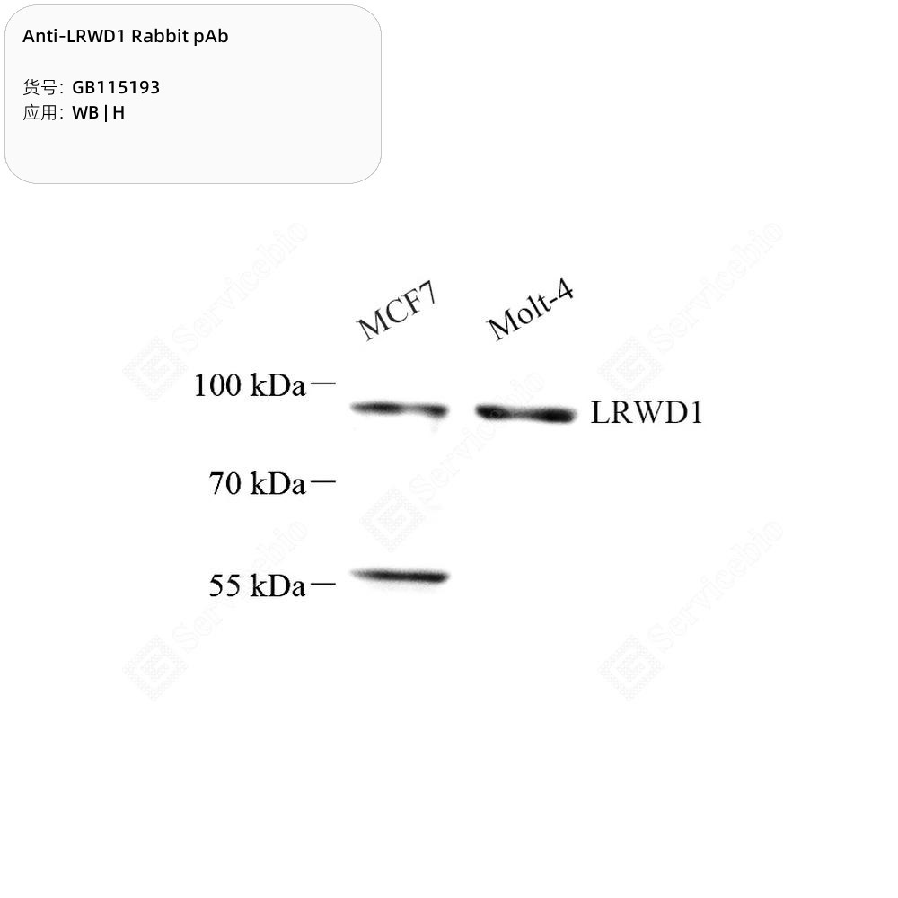 Anti-LRWD1 Rabbit pAb