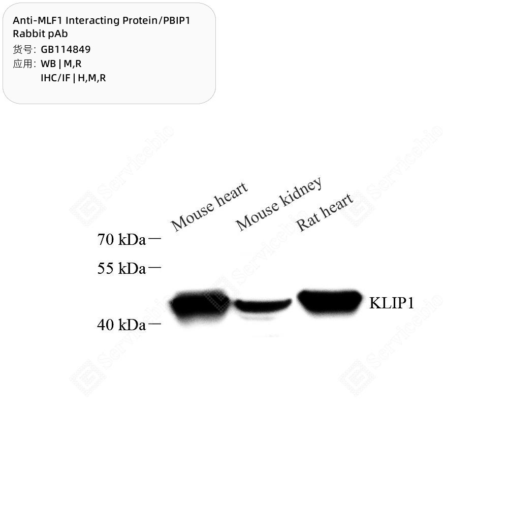Anti-MLF1 Interacting Protein/PBIP1 Rabbit pAb