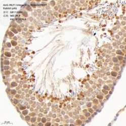 Anti-MLF1 Interacting Protein/PBIP1 Rabbit pAb