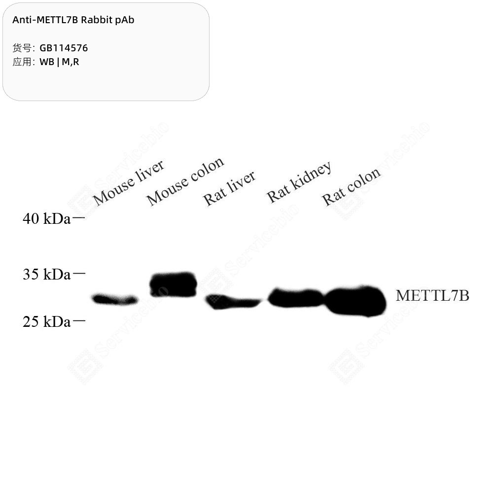 Anti-METTL7B Rabbit pAb