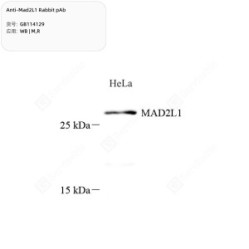 Anti-Mad2L1 Rabbit pAb