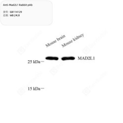 Anti-Mad2L1 Rabbit pAb