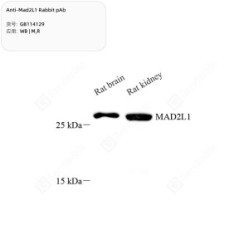 Anti-Mad2L1 Rabbit pAb