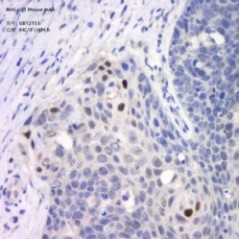 Anti-p21 Mouse mAb