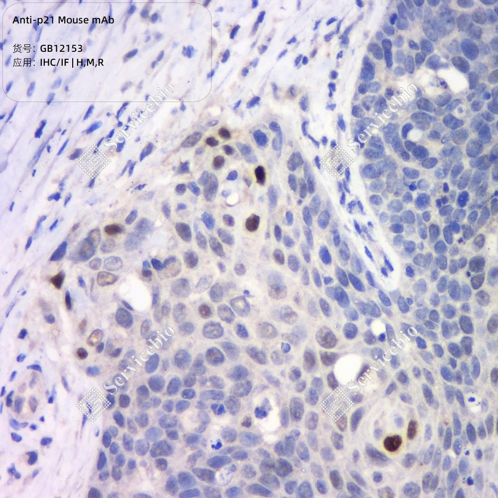 Anti-p21 Mouse mAb