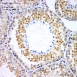 Anti-p21 Mouse mAb