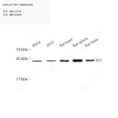 Anti-p27 KIP 1 Rabbit pAb