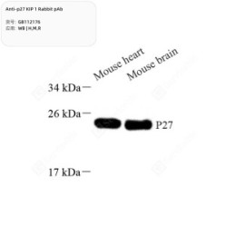 Anti-p27 KIP 1 Rabbit pAb