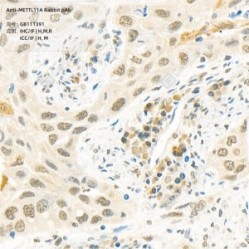 Anti-METTL11A Rabbit pAb