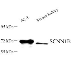 Anti-SCNN1B Rabbit pAb, Primary Antibody