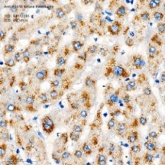Anti-p70 S6 Kinase Rabbit pAb