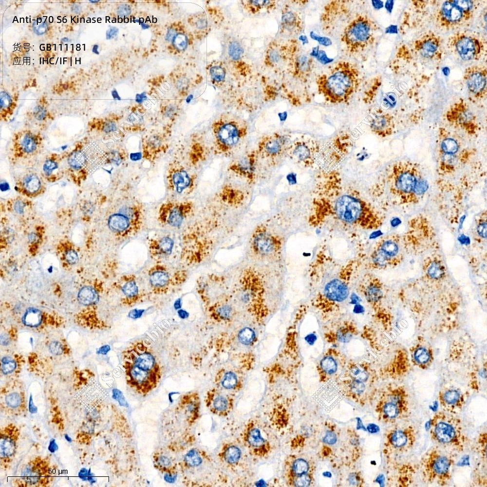 Anti-p70 S6 Kinase Rabbit pAb