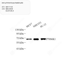 Anti-p70 S6 Kinase Rabbit pAb