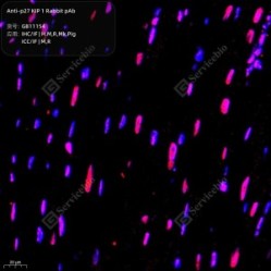 Anti-p27 KIP 1 Rabbit pAb