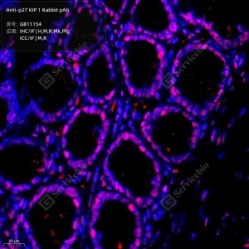 Anti-p27 KIP 1 Rabbit pAb