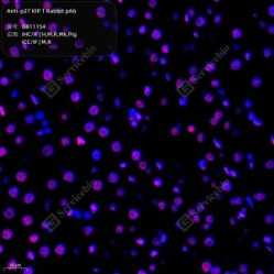 Anti-p27 KIP 1 Rabbit pAb