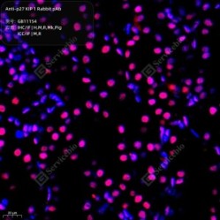 Anti-p27 KIP 1 Rabbit pAb