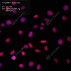 Anti-p27 KIP 1 Rabbit pAb