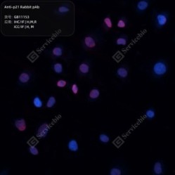 Anti-p21 Rabbit pAb