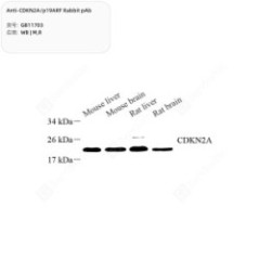 Anti-CDKN2A/p19ARF Rabbit pAb