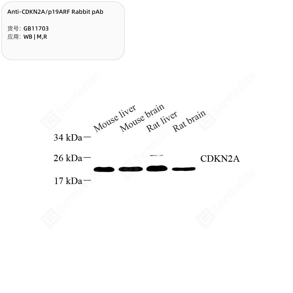 Anti-CDKN2A/p19ARF Rabbit pAb