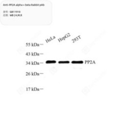 Anti-PP2A alpha + beta...