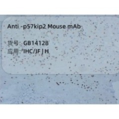 Anti-p57kip2 Mouse mAb