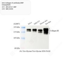 Anti-Collagen III antibody...
