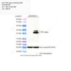Anti-TNF-alpha antibody...
