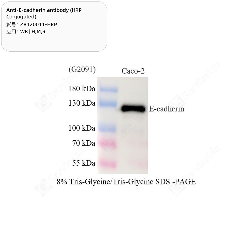 Anti-E-cadherin antibody (HRP Conjugated)