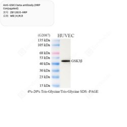 Anti-GSK3 beta antibody (HRP Conjugated)