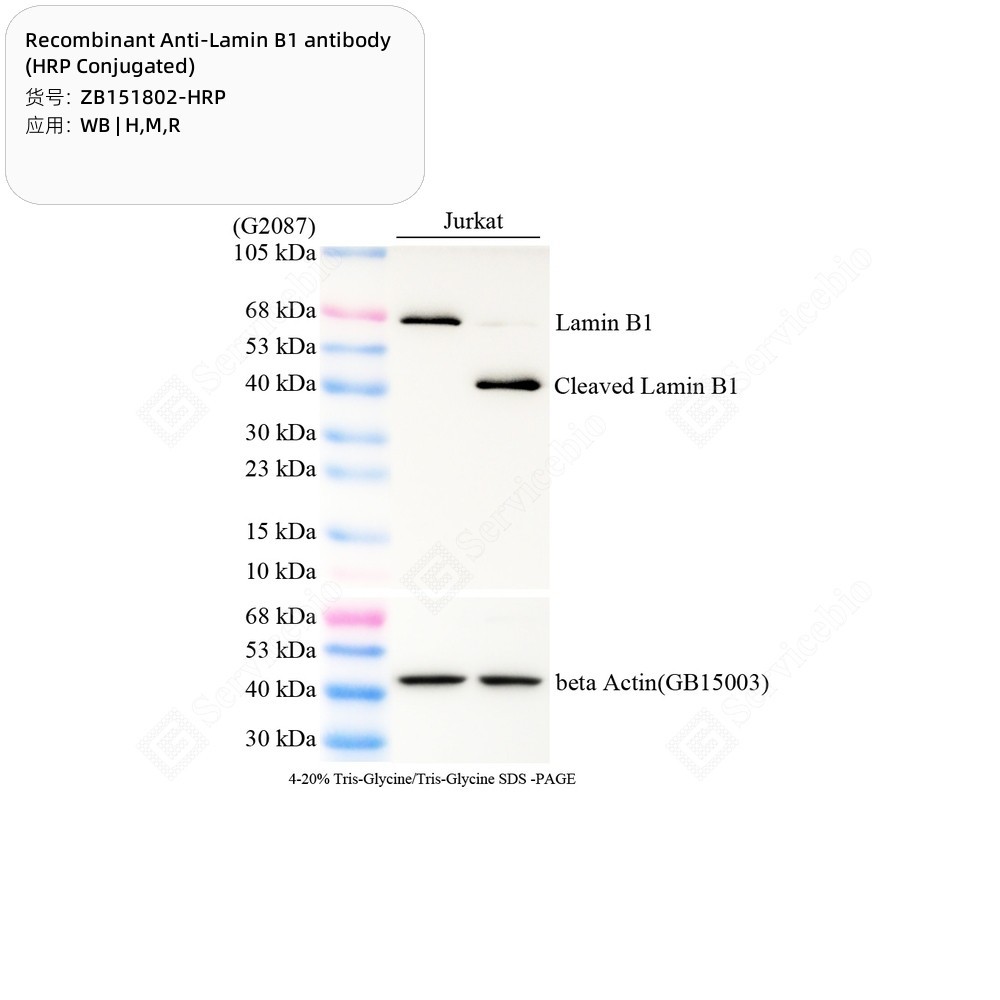 Recombinant Anti-Lamin B1 antibody (HRP Conjugated)