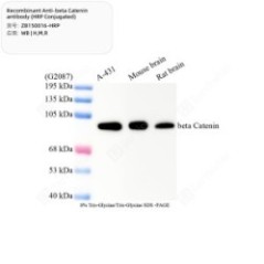 Recombinant Anti-beta...