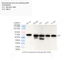 Recombinant Anti-p53 antibody (HRP Conjugated)