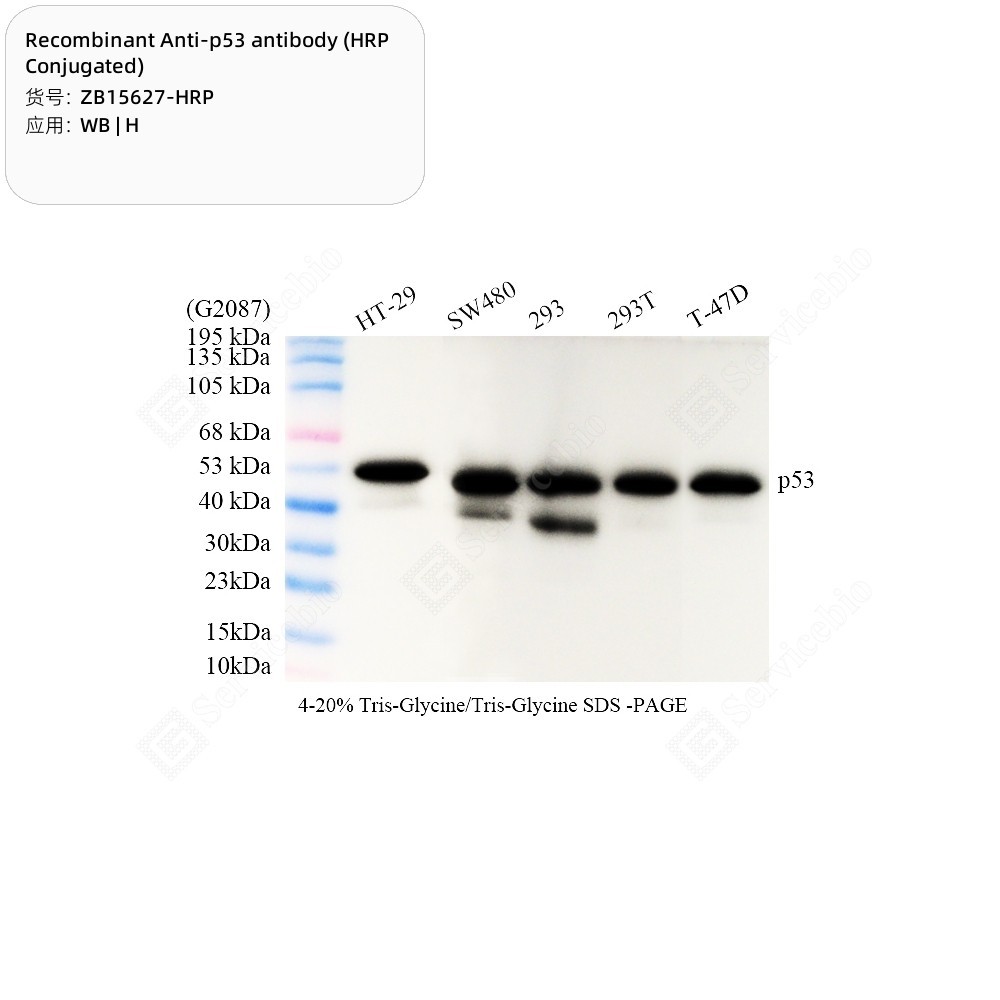 Recombinant Anti-p53 antibody (HRP Conjugated)