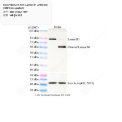 Recombinant Anti-Lamin B1 antibody (HRP Conjugated)