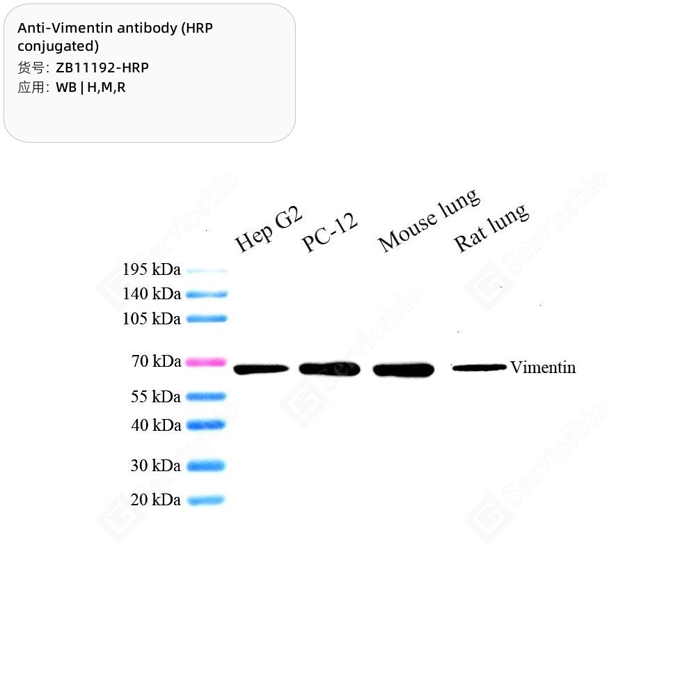 Anti-Vimentin antibody (HRP conjugated)