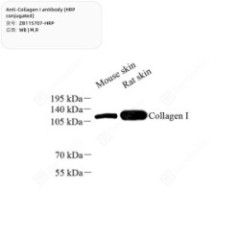 Anti-Collagen I antibody...