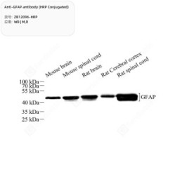 Anti-GFAP antibody (HRP Conjugated)