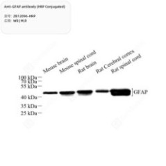 Anti-GFAP antibody (HRP...