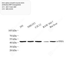Anti-alpha smooth muscle Actin antibody (HRP Conjugated)