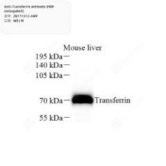 Anti-Transferrin antibody...