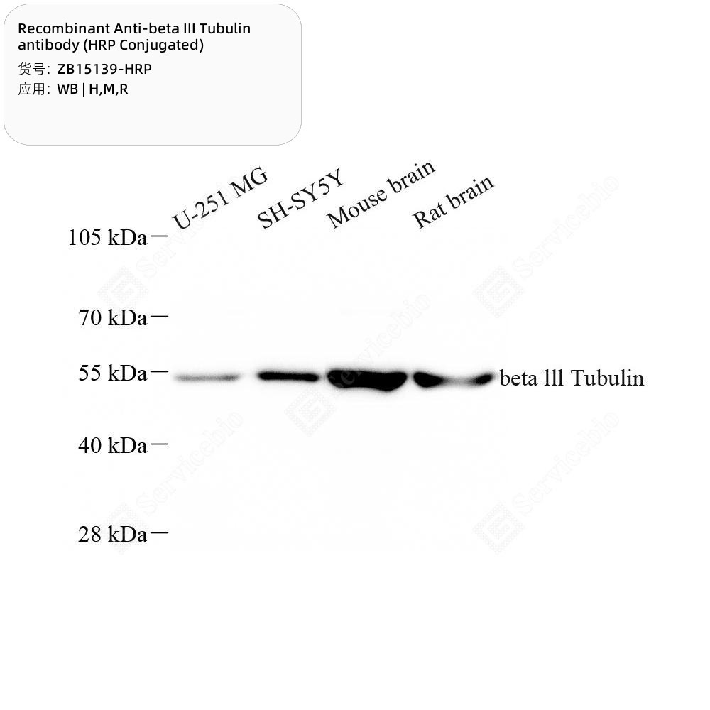 Recombinant Anti-beta III Tubulin antibody (HRP Conjugated)