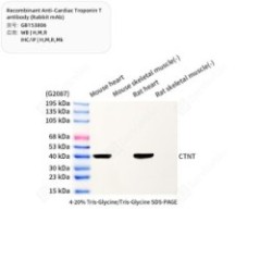 Recombinant Anti-Cardiac...