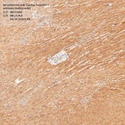 Recombinant Anti-Cardiac Troponin T antibody (Rabbit mAb)