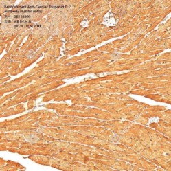 Recombinant Anti-Cardiac Troponin T antibody (Rabbit mAb)