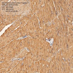 Recombinant Anti-Cardiac Troponin T antibody (Rabbit mAb)