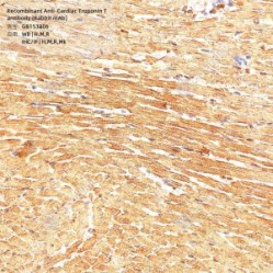 Recombinant Anti-Cardiac Troponin T antibody (Rabbit mAb)